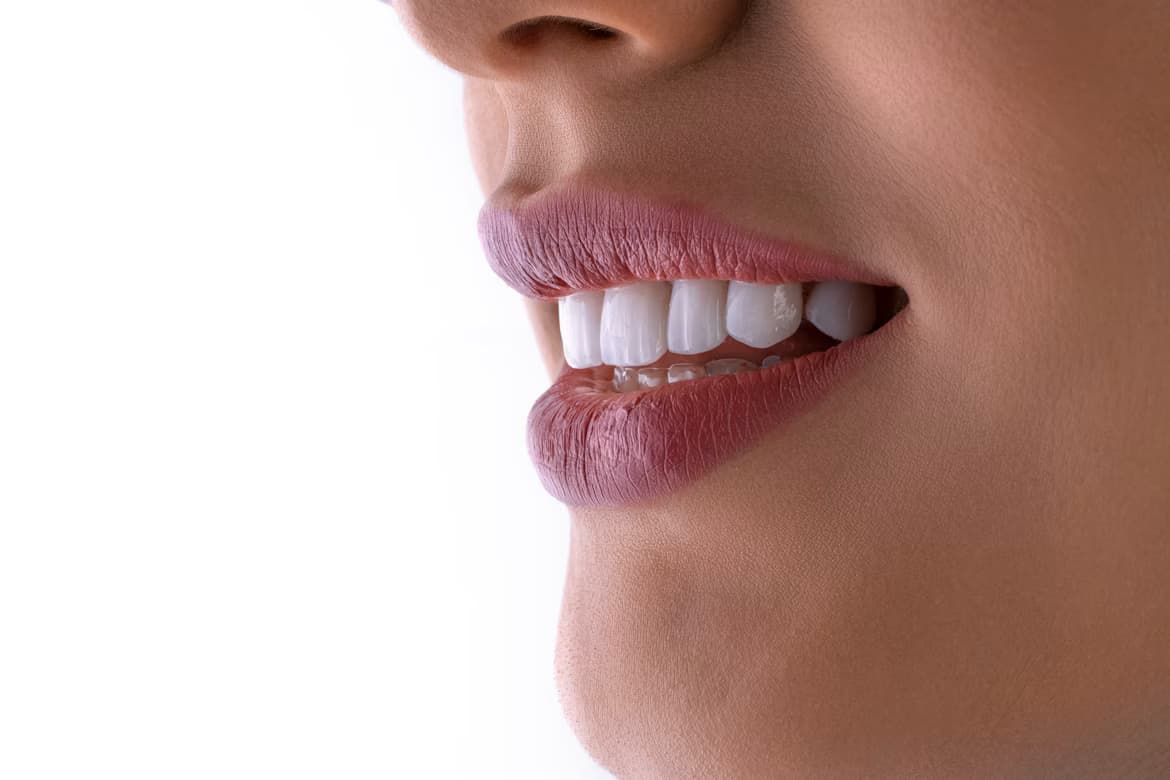 Estética dental